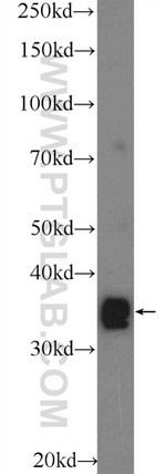 TEX264 Antibody in Western Blot (WB)