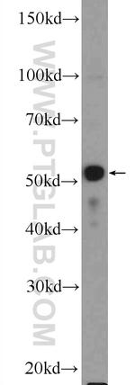 PLAGL1 Antibody in Western Blot (WB)