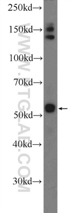 PLAGL1 Antibody in Western Blot (WB)