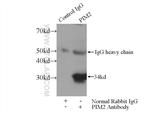 PIM2 Antibody in Immunoprecipitation (IP)