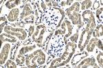 PI3 Kinase p85 Beta Antibody in Immunohistochemistry (Paraffin) (IHC (P))