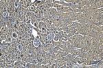 PI3 Kinase p85 Beta Antibody in Immunohistochemistry (Paraffin) (IHC (P))