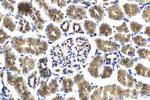 PI3 Kinase p85 Beta Antibody in Immunohistochemistry (Paraffin) (IHC (P))