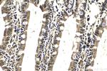 PI3 Kinase p85 Beta Antibody in Immunohistochemistry (Paraffin) (IHC (P))