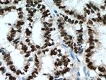 PR Antibody in Immunohistochemistry (Paraffin) (IHC (P))