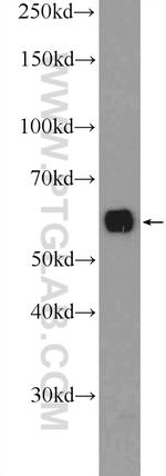 LY6G6F Antibody in Western Blot (WB)