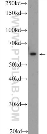 LY6G6F Antibody in Western Blot (WB)
