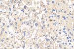 Alpha-1-antitrypsin Antibody in Immunohistochemistry (Paraffin) (IHC (P))