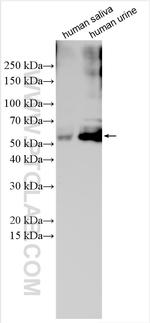 Alpha-1-antitrypsin Antibody in Western Blot (WB)