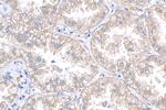 CMPK2 Antibody in Immunohistochemistry (Paraffin) (IHC (P))