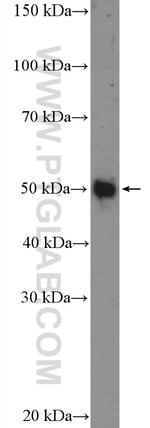 Whirlin Antibody in Western Blot (WB)