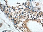 AMHR2 Antibody in Immunohistochemistry (Paraffin) (IHC (P))