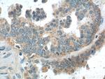 AMHR2 Antibody in Immunohistochemistry (Paraffin) (IHC (P))
