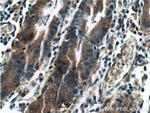 LIPF Antibody in Immunohistochemistry (Paraffin) (IHC (P))