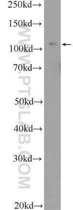 TRPC5 Antibody in Western Blot (WB)