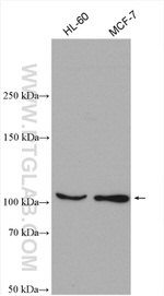 TRPC5 Antibody in Western Blot (WB)