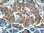 MTR Antibody in Immunohistochemistry (Paraffin) (IHC (P))