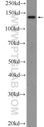 MTR Antibody in Western Blot (WB)