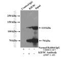 KIF5C Antibody in Immunoprecipitation (IP)