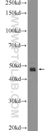 GABRR1 Antibody in Western Blot (WB)