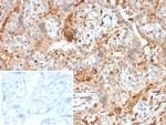 AMBP (Alpha 1 Microglobulin)/Bikunin Monoclonal Antibody (AMBP/4536)
