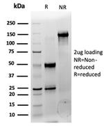 CCR4-NOT transcription complex, subunit 10 (CNOT10) Antibody in SDS-PAGE (SDS-PAGE)