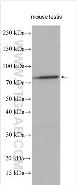 TRIM36 Antibody in Western Blot (WB)