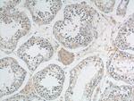 PEMT Antibody in Immunohistochemistry (Paraffin) (IHC (P))