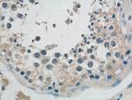 PEMT Antibody in Immunohistochemistry (Paraffin) (IHC (P))