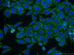 GMIP Antibody in Immunocytochemistry (ICC/IF)