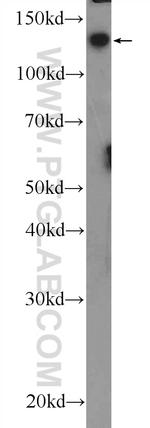 GMIP Antibody in Western Blot (WB)