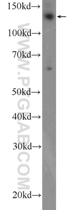 GMIP Antibody in Western Blot (WB)