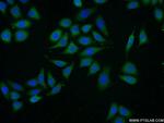 APOL2 Antibody in Immunocytochemistry (ICC/IF)