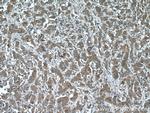 IQGAP3 Antibody in Immunohistochemistry (Paraffin) (IHC (P))