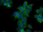 TCHP Antibody in Immunocytochemistry (ICC/IF)