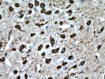 PCP4L1 Antibody in Immunohistochemistry (Paraffin) (IHC (P))