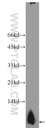 PCP4L1 Antibody in Western Blot (WB)