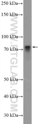 HAL Antibody in Western Blot (WB)