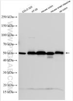 GPA33 Antibody in Western Blot (WB)