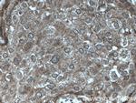 PTPN13 Antibody in Immunohistochemistry (Paraffin) (IHC (P))