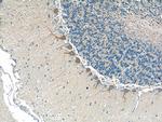 CSF1R Antibody in Immunohistochemistry (Paraffin) (IHC (P))