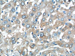 C11orf80 Antibody in Immunohistochemistry (Paraffin) (IHC (P))
