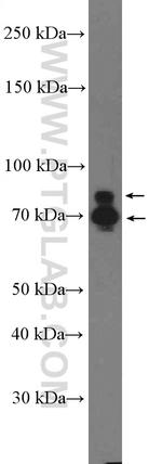 C11orf80 Antibody in Western Blot (WB)