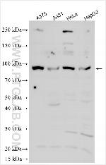 CXorf57 Antibody in Western Blot (WB)