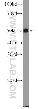 UT-B Antibody in Western Blot (WB)