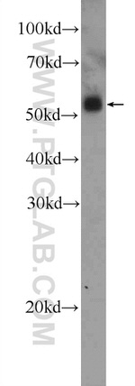 UT-B Antibody in Western Blot (WB)