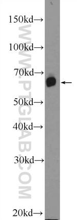 GALNT9 Antibody in Western Blot (WB)