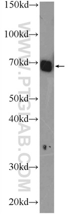 RCOR3 Antibody in Western Blot (WB)