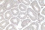 NPHP1 Antibody in Immunohistochemistry (Paraffin) (IHC (P))