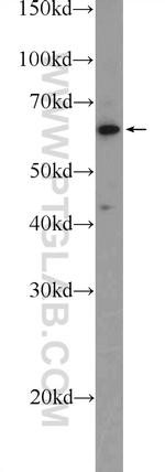 TESPA1 Antibody in Western Blot (WB)